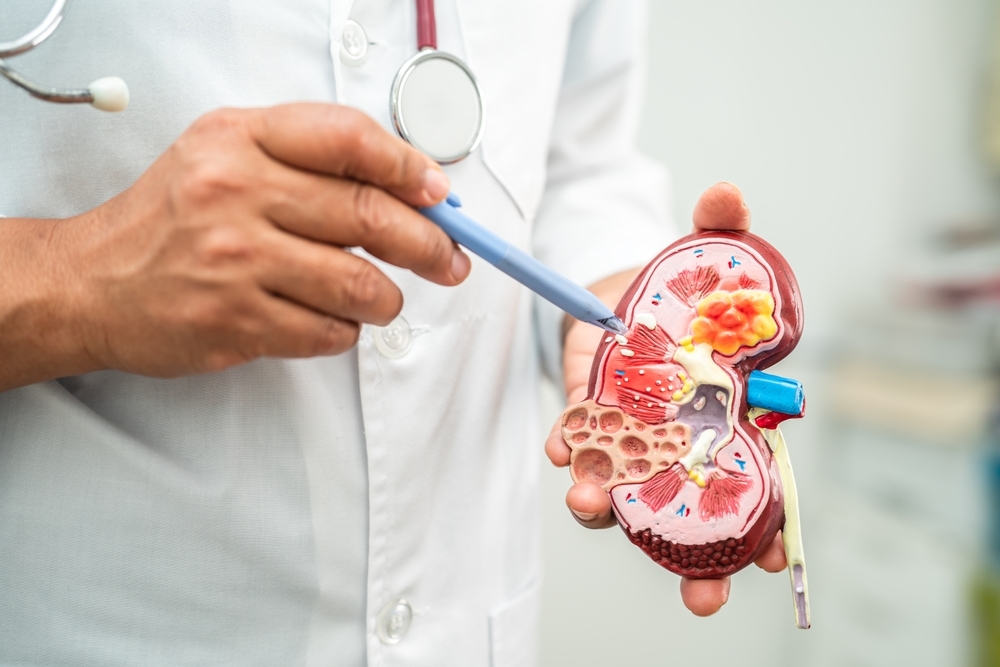 What is a nephrologist?